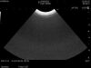 HITACHI C22T Ultrasound Transducer