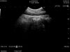 HITACHI C22T Ultrasound Transducer
