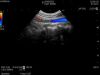 HITACHI C22T Ultrasound Transducer