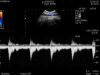 HITACHI C22T Ultrasound Transducer