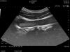 HITACHI C42K Ultrasound Transducer