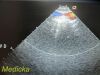 ACUSON 7V3C Phased Array Ultrasound Transducer Probe Ultrasound Transducer