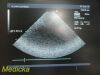 ACUSON 7V3C Phased Array Ultrasound Transducer Probe *TESTED* Ultrasound Transducer