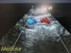 ACUSON 7V3C Phased Array Ultrasound Transducer Probe *TESTED* Ultrasound Transducer