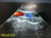 ACUSON 7V3C Phased Array Ultrasound Transducer Probe *TESTED* Ultrasound Transducer