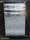 ACUSON 15L8w Model 08241113 Ergo Linear Array Ultrasound Transducer Probe Ultrasound Transducer