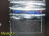 ACUSON 15L8w Model 08241113 Ergo Linear Array Ultrasound Transducer Probe Ultrasound Transducer