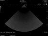 HITACHI S31KP Ultrasound Transducer