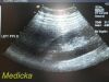 ACUSON 8C4 Model 08241118 Convex Array Ultrasound Transducer