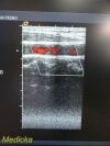 ACUSON 6L3 Linear Array Ultrasound Transducer Probe Ultrasound Transducer