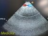 ACUSON 7V3C Phased Array Ultrasound Transducer / Probe Ultrasound Transducer