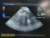 ACUSON 7V3C Model 08260630 Phased Array Ultrasound Transducer