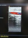 ACUSON 15L8 Ergo Linear Array (LA) Ultrasound Transducer
