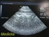 ACUSON 7V3C Phased Array Ultrasound Transducer