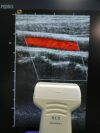 ACUSON 6L3 Model 08241112 Linear Array Ultrasound Transducer