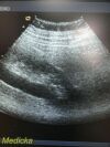 ACUSON 8C4 Convex Array Ultrasound Transducer