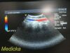 ACUSON 8C4 Convex Array Ultrasound Transducer