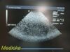 ACUSON 10V4 Vector Array Ultrasound Transducer