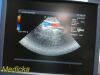 ACUSON 10V4 Vector Array Ultrasound Transducer
