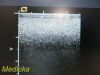 ACUSON 15L8 Ergo Linear Array Ultrasound Transducer