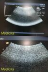 ACUSON 8C4 Convex Array Ultrasound Transducer
