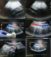 ACUSON 8C4 Convex Array Ultrasound Transducer