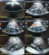 ACUSON 4V2 Phased Array Ultrasound Transducer