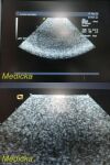 ACUSON 4V2 Phased Array Ultrasound Transducer