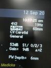 ACUSON 4V2 Phased Array Ultrasound Transducer