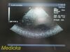 ACUSON 4V2 Vector Array Ultrasound Transducer