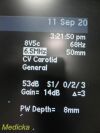 ACUSON 4V2 Vector Array Ultrasound Transducer