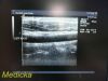 ACUSON 15L8W Linear Array Ultrasound Transducer Probe *TESTED & WORKING* Ultrasound Transducer