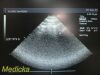 ACUSON 7V3C Phased Array Ultrasound Probe / Transducer ~ 22586 Ultrasound Transducer