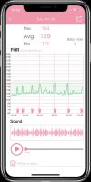 WELLUE Babytone Fetal Doppler Fetal Doppler