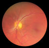DEC 1000P Fundus Camera