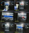ACUSON 6L3 Model 08241112 Linear Array Ultrasound Transducer