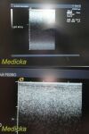 ACUSON 15L8 Ergo Linear Array Ultrasound Transducer