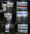 ACUSON 6L3 Linear Array Ultrasound Transducer Probe Ultrasound Transducer