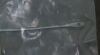 W. LORENZ 1/1/7827 Curette