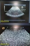 ACUSON 10V4 Model 08266709 Vector Array Ultrasound Transducer