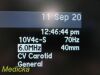 ACUSON 10V4 Model 08266709 Vector Array Ultrasound Transducer