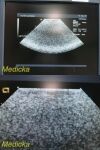 ACUSON 4V2 Vector/Sector Array Ultrasound Transducer Probe Ultrasound Transducer
