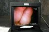 VISION SCIENCES BRS-5100 WITH DPU-7000A VIDEO PROCESSOR Bronchoscope