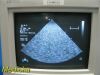 HEWLETT PACKARD Agilent Philips S4 P/N 21330A Phased Array Ultrasound Transducer