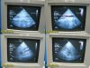 HEWLETT PACKARD Agilent Philips S4 P/N 21330A Phased Array Ultrasound Transducer