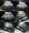 ACUSON 4V2 Sector Array Ultrasound Transducer