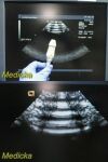 ACUSON 7V3C Vector Array Ultrasound Transducer Probe Ultrasound Transducer
