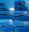 Assorted Laparoscopic Genitourinary Instruments W/ Staple Remover & Cable