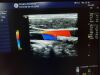 GE 9L-D Ultrasound Transducer