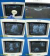 SIEMENS 2007  Sonoline G20 Diag Ultrasound Transducer